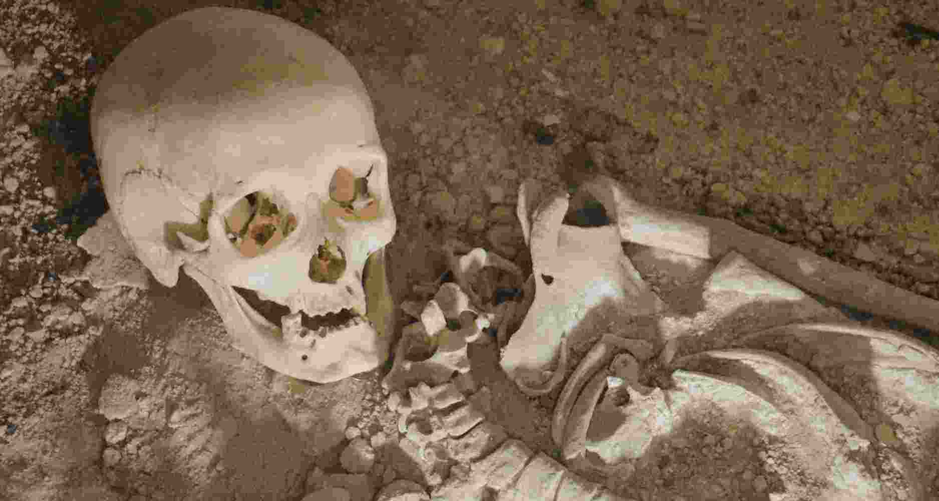 Representative Image. 