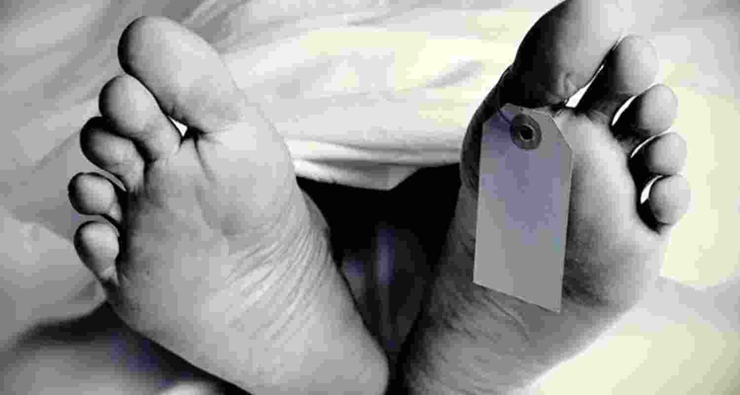 Representative Image. 