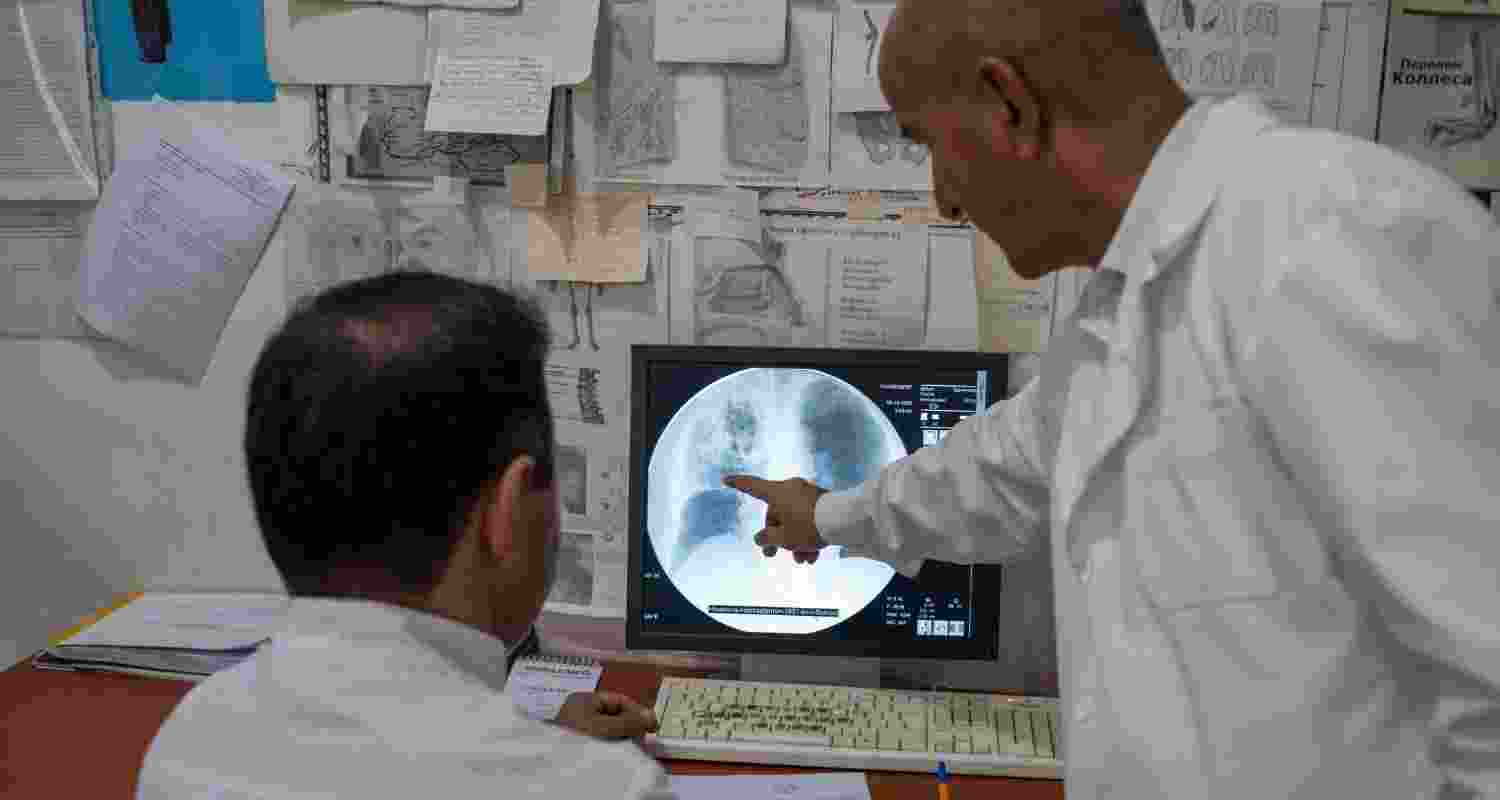 Representational image. Representational image.