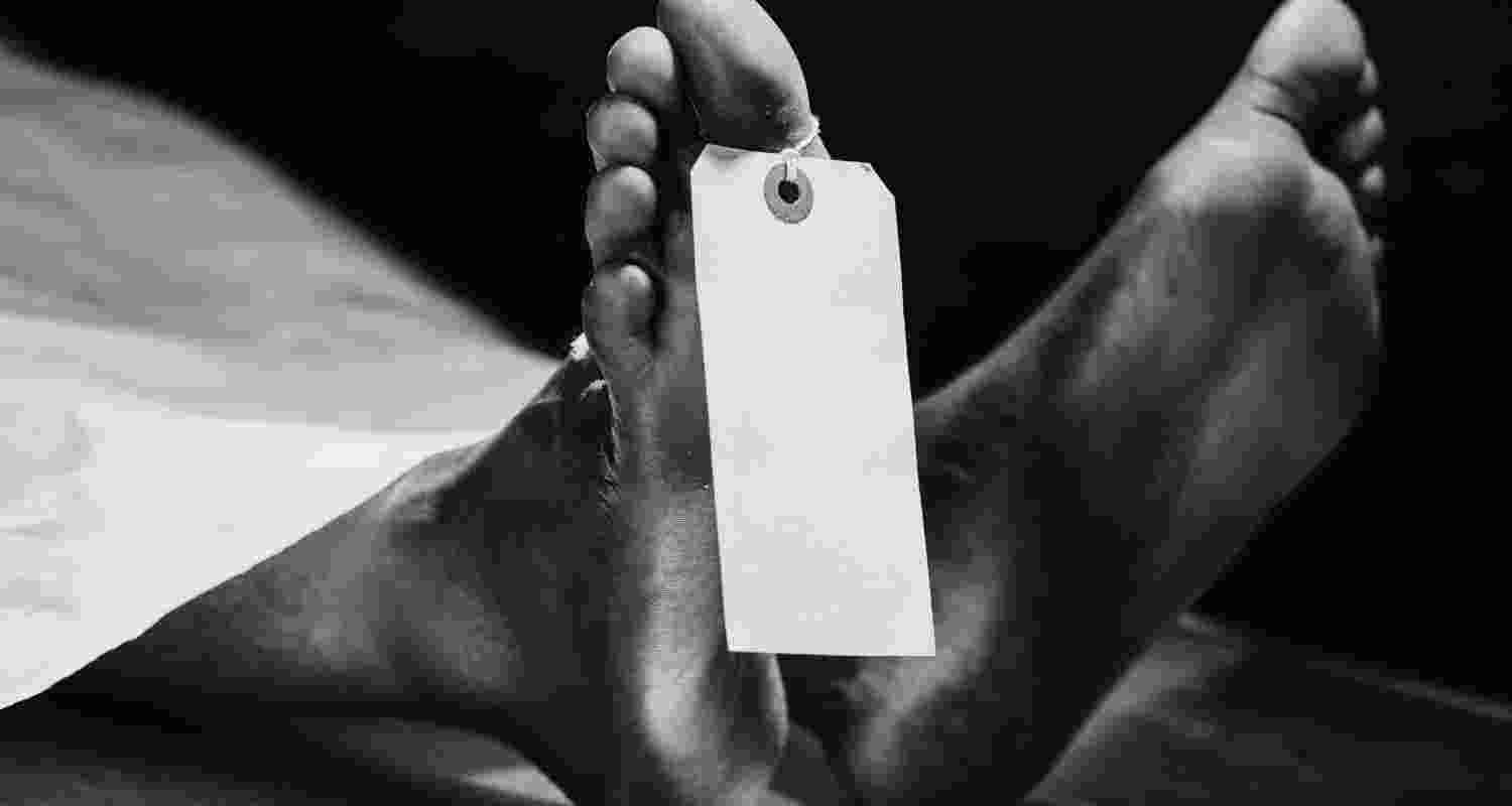 Representative Image. 