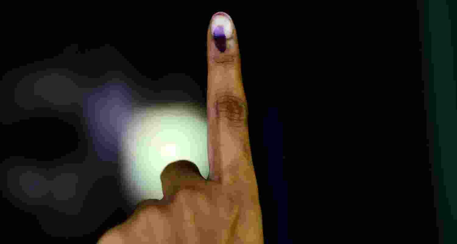 Representative Image. 