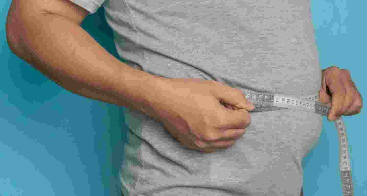 Representative image.