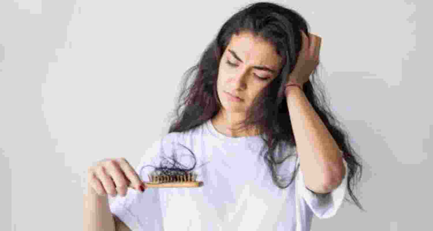 Hair loss can be a symptom of androgen excess.
