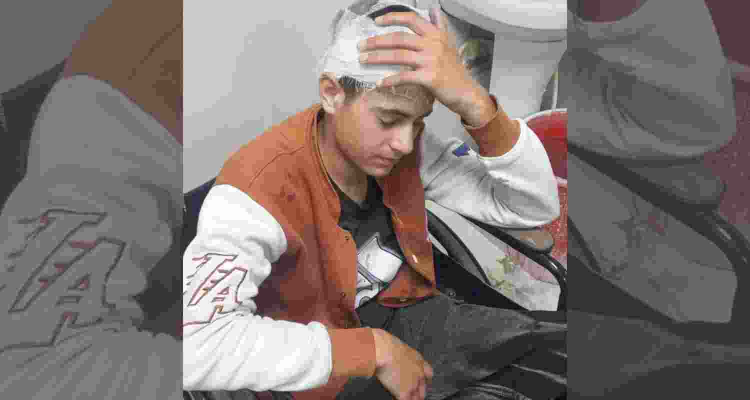 A young Kashmiri boy who was assaulted in Uttarakhand. A young Kashmiri boy who was assaulted in Uttarakhand.