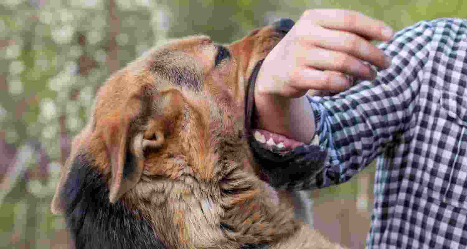 Representative Image of a dog bite. Representative Image of a dog bite.