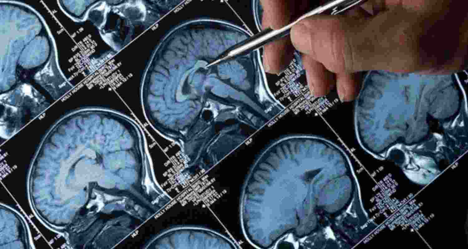 Kerala leads in nation's fight against amoebic brain fever Kerala leads in nation's fight against amoebic brain fever