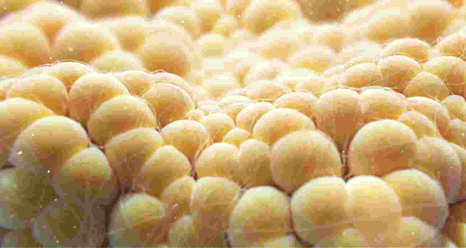 How fat cells could burn away obesity How fat cells could burn away obesity