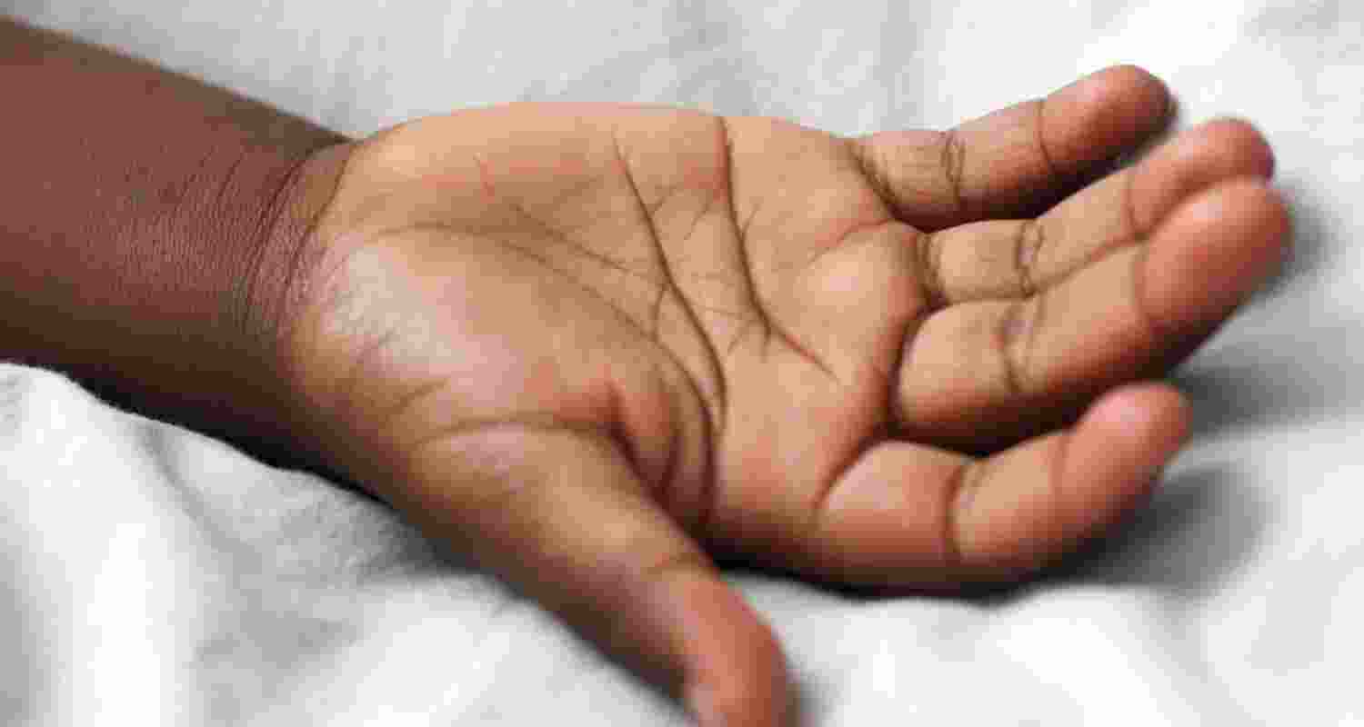 The suspicious deaths have caused alarm in the area, leading to the ealth department setting up a medical camp in the village and launching a probe into the cause of the deaths, the officials said The suspicious deaths have caused alarm in the area, leading to the ealth department setting up a medical camp in the village and launching a probe into the cause of the deaths, the officials said