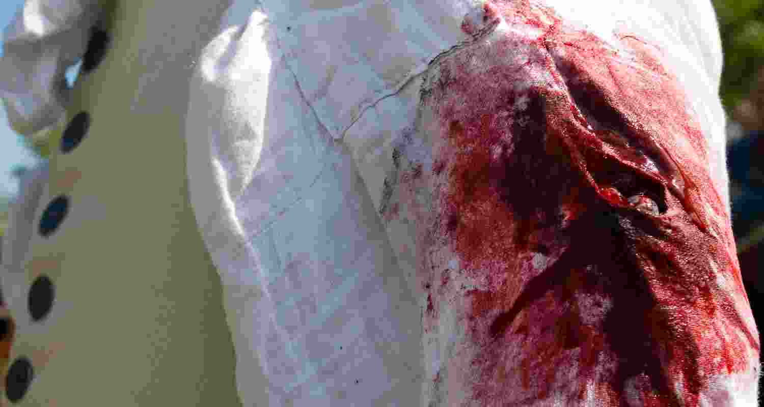 Representative Image. Representative Image.