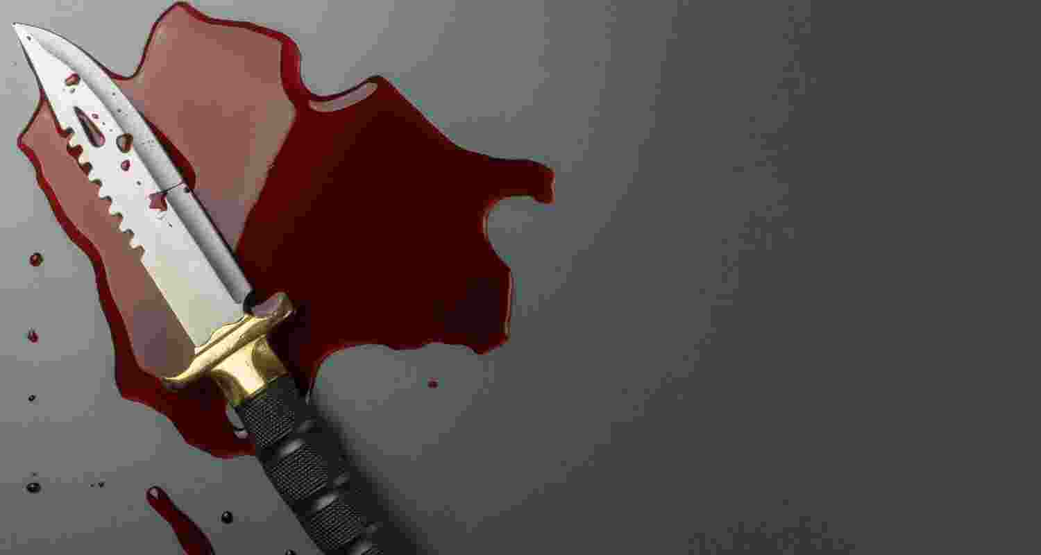 Representative Image. Representative Image.