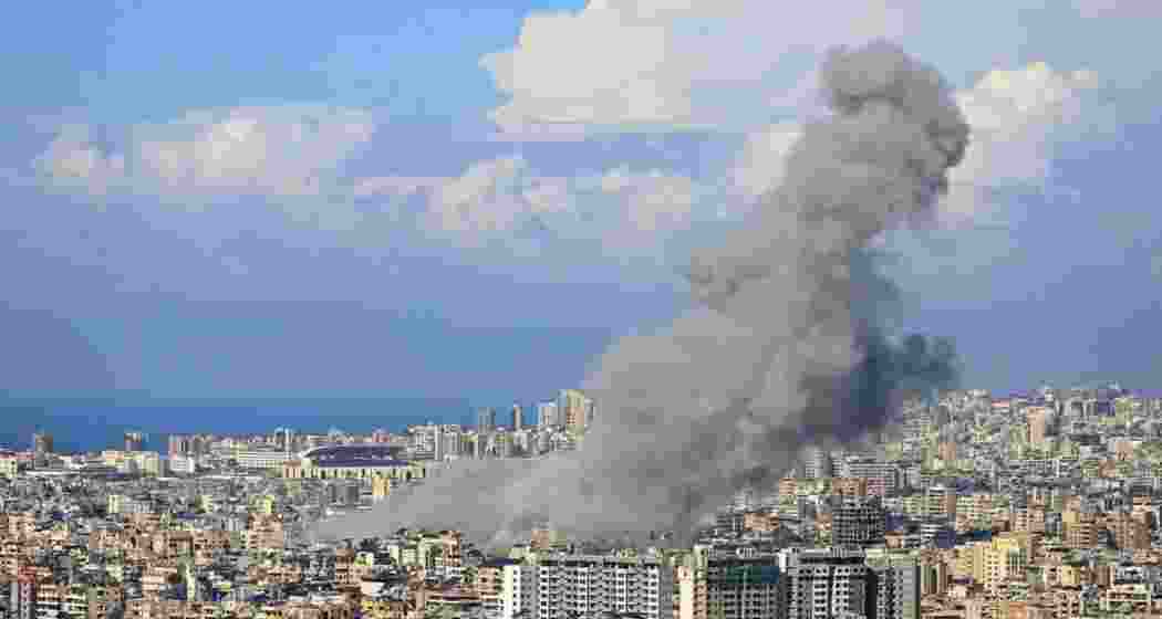 Representative image. Representative image.