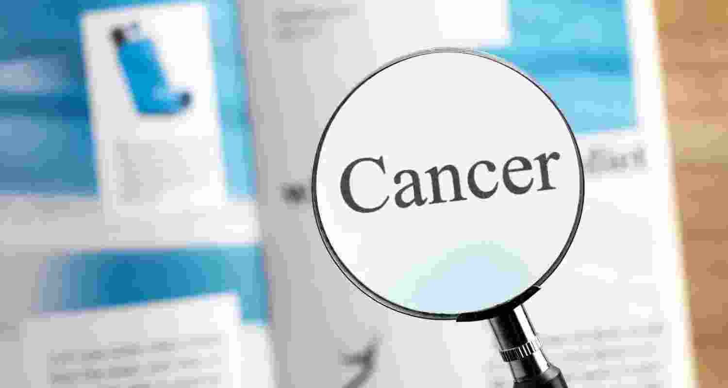 SC asks 19 states, UTs to declare cancer 'notifiable disease' SC asks 19 states, UTs to declare cancer 'notifiable disease'