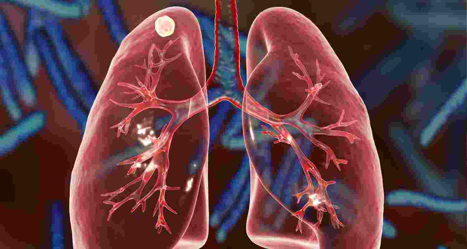 Representative Image. Representative Image.