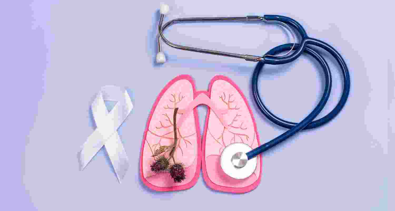 Representative Image. Representative Image.