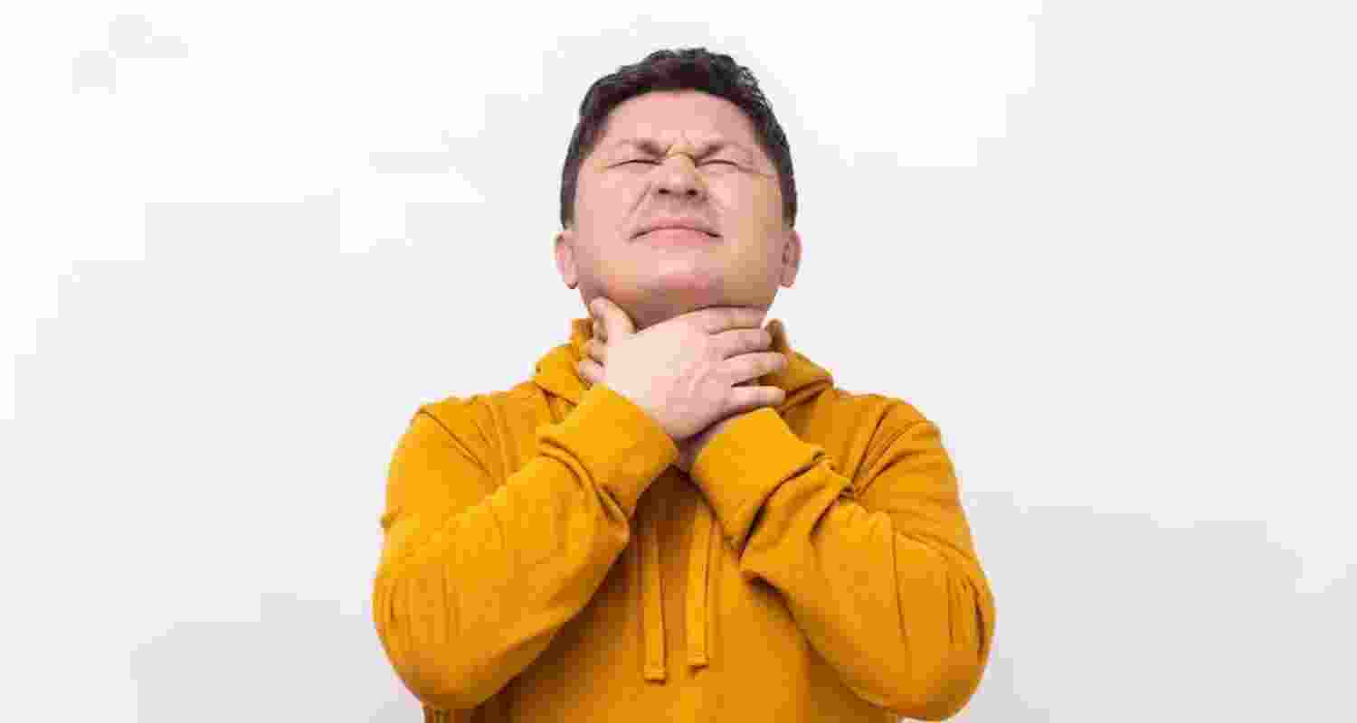 Representational image. Representational image.